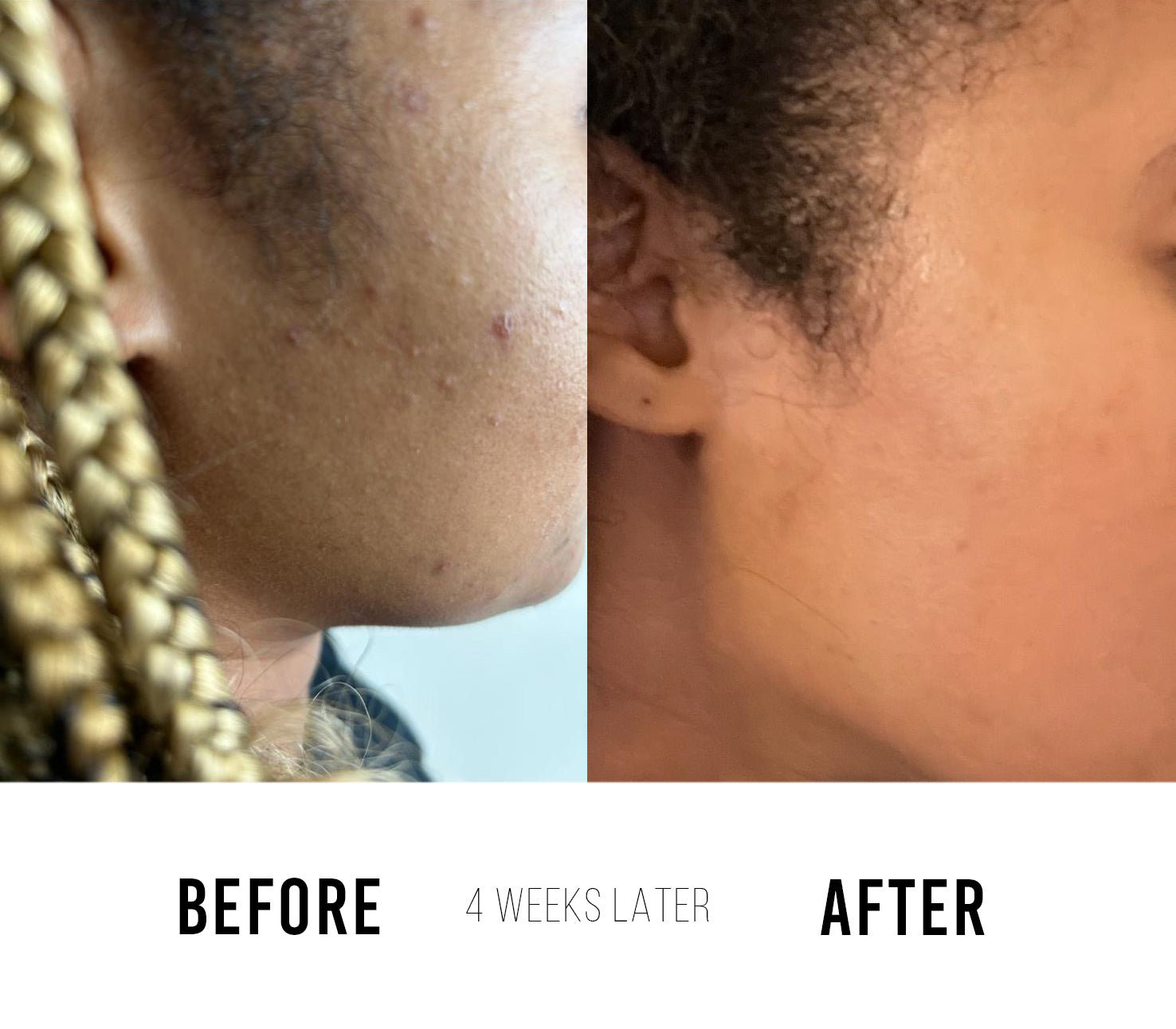 RE-JUV Before and After Results